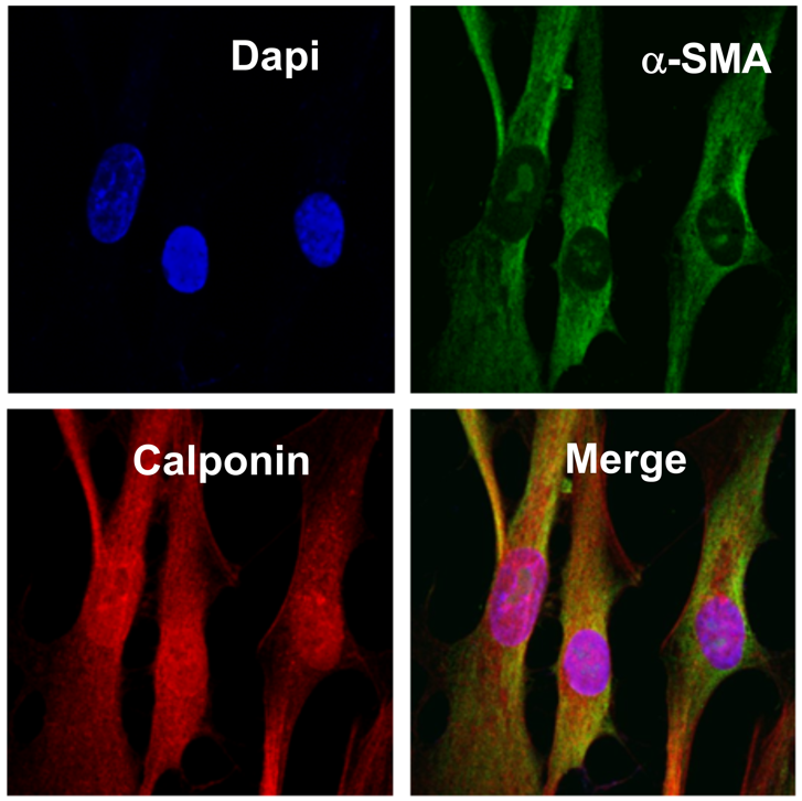 Images de microscopie à fluorescence sur des cellules de muscle lisse bronchique.
