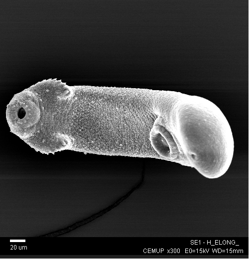 Photo au microscope électronique à balayage d'un stade larvaire (métacercaires) de parasite du groupe des trématodes.